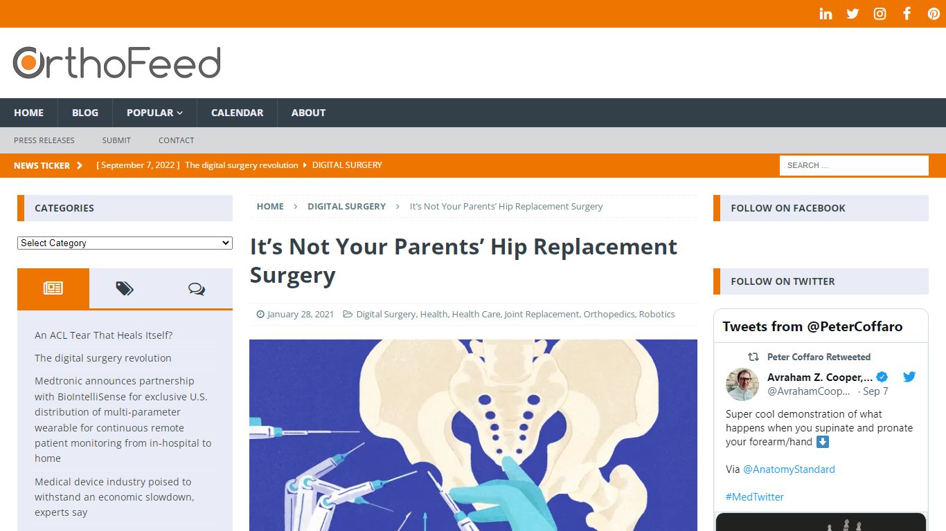 It’s Not Your Parents’ Hip Replacement Surgery – OrthoFeed